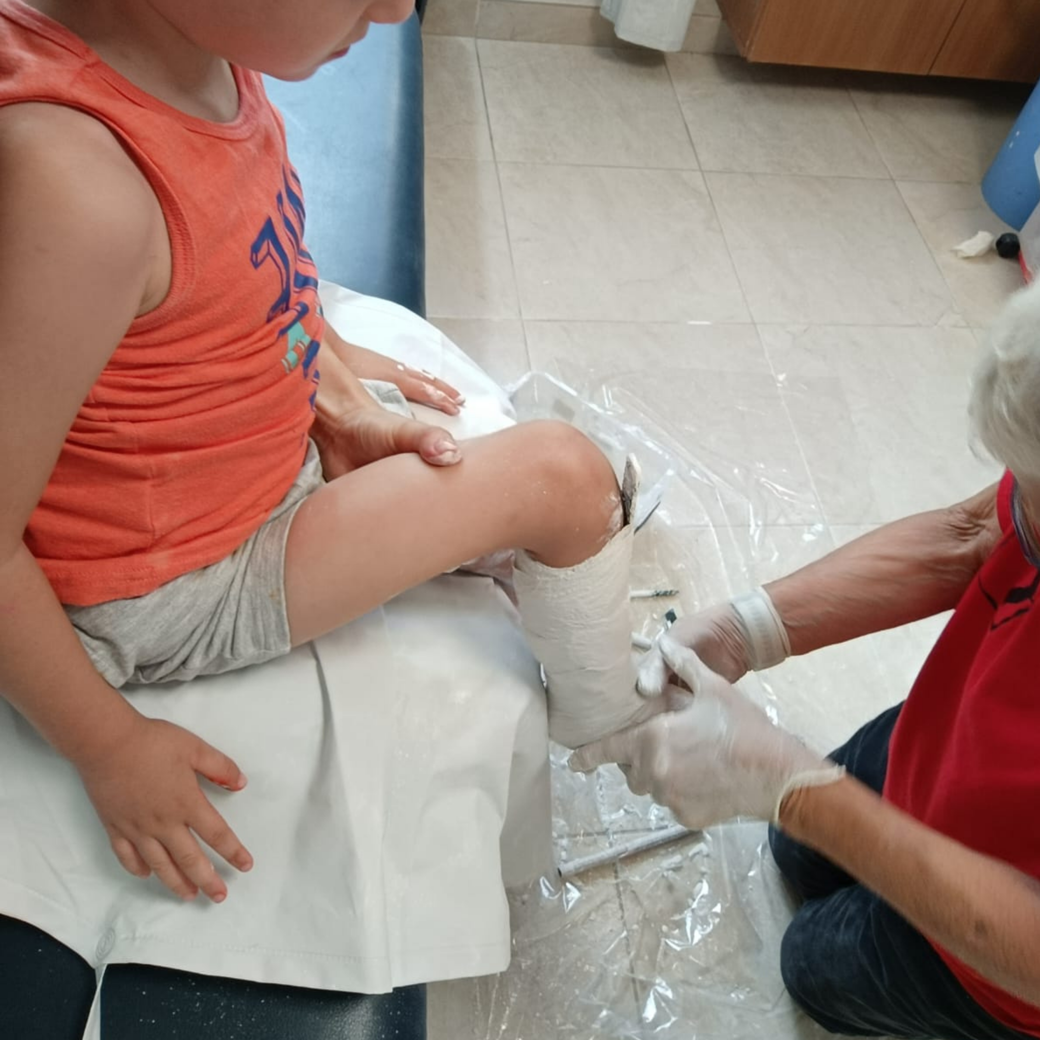 Child in clinic having plaster cast applied to leg, wearing shorts and orange shirt